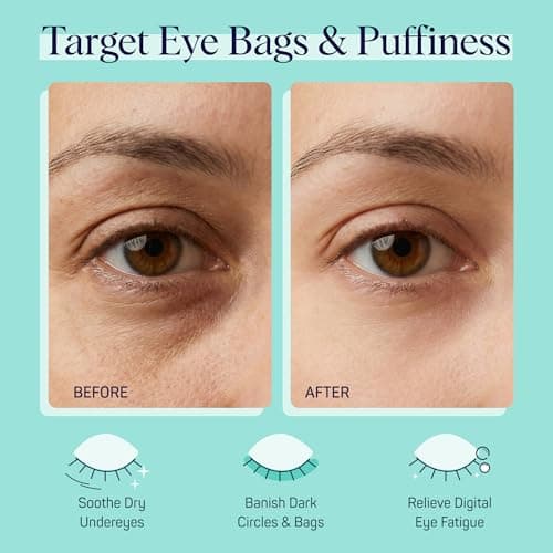 SpaLife Cooling Cucumber Eye Pads | Mothers Day Gifts & Korean Dark Circles & Puffy Eyes Treatment | Nourishing Cucumber Eye Pads | Eye Mask for Puffy Eyes Daily Depuffing Eye Patches | 4 Packs of 12