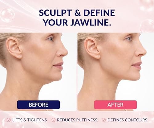 Stylia V Line Lifting Collagen Mask - Lift, Firm & Contour Jawline - Tightening Double Chin Strap with Hyaluronic Acid & Aloe - Neck Tightening and Lifting Mask - Jawline Shaper Face Lift Tape (10PC)