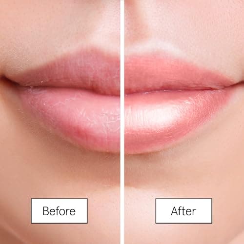 grace & stella Award Winning Lip Butter - Hydrating Lip Balm - Nourishing Lip Mask (1-pack) Travel Essentials, Travel Size Toiletries, Birthday Gifts for Women & Teens - Overnight Lip Repair - Vegan